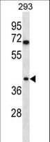 TOR1B / Torsin B Antibody (aa215-243)