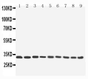 Polyclonal Rabbit anti-Human APG5 / ATG5 Antibody (aa82-97, WB)