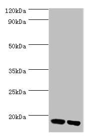 FKBP2 Antibody (aa22-142)