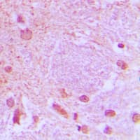 TCF3 / E2A Antibody (C-Terminus)