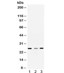 SRI / Sorcin Antibody