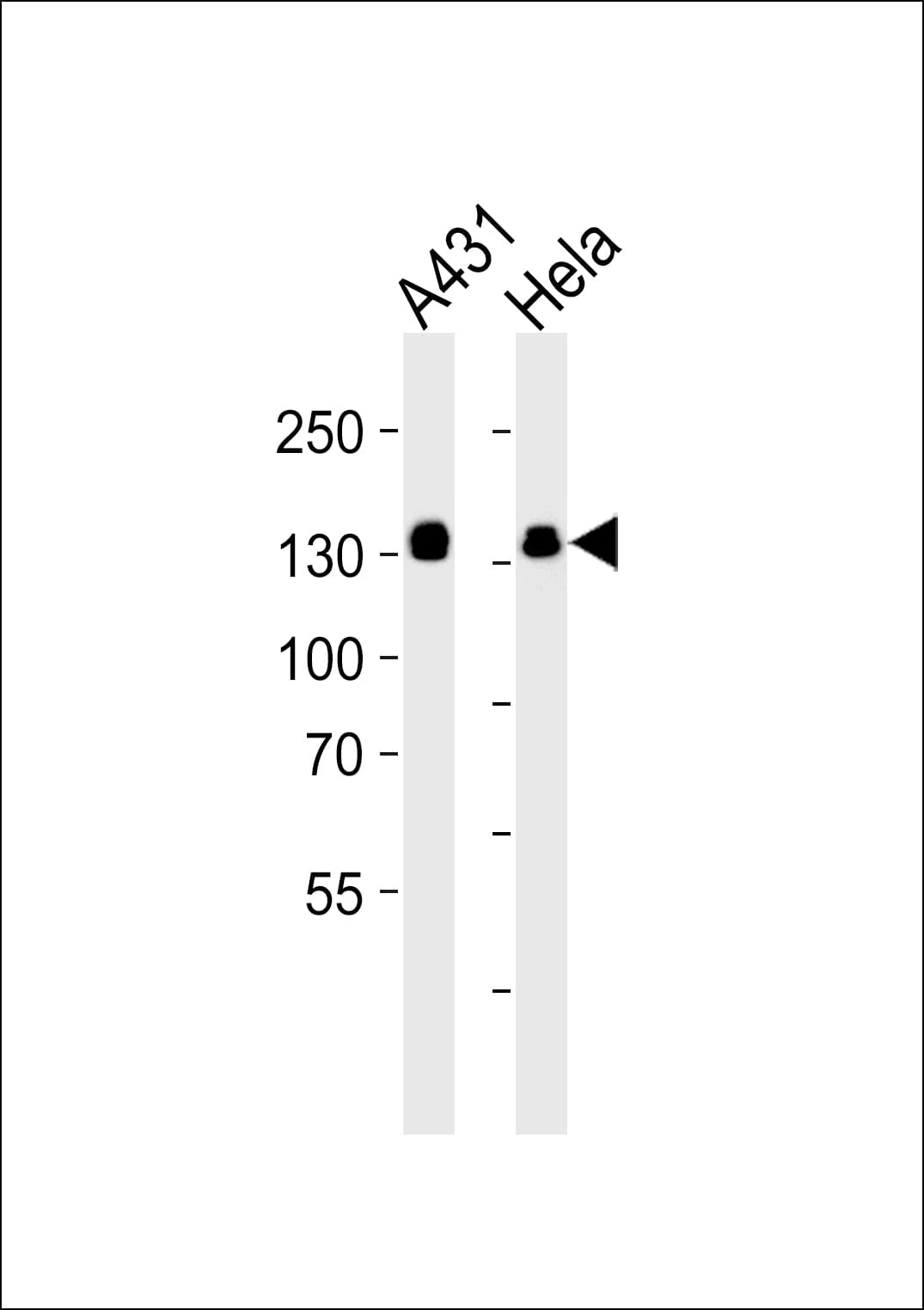 IHC-plus™ Polyclonal Rabbit anti-Human GTF2I / TFII I Antibody (aa956-985, IHC, IF, WB)