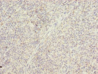TMTC4 Antibody