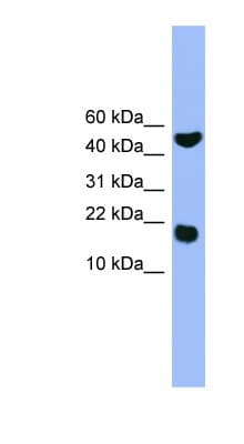 Polyclonal Rabbit anti-Human RWDD1 Antibody (aa41-90, WB)
