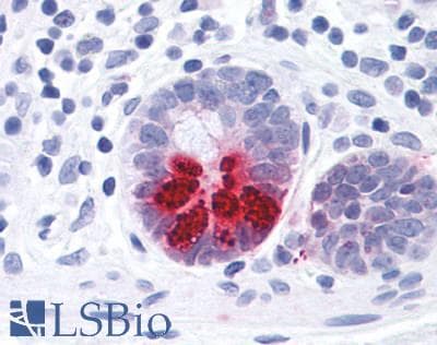 PathPlus™ Polyclonal Rabbit anti-Human Prostaglandin D2 Receptor Antibody (N-Terminus, IHC)