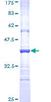 Human MMP26 Protein (Recombinant GST, N-terminus)