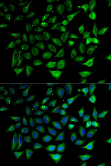 SLC25A20 / CACT Antibody