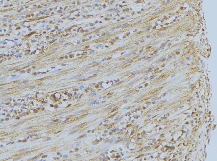 Polyclonal Rabbit anti-Human PEX7 Antibody (IHC, IF, WB)