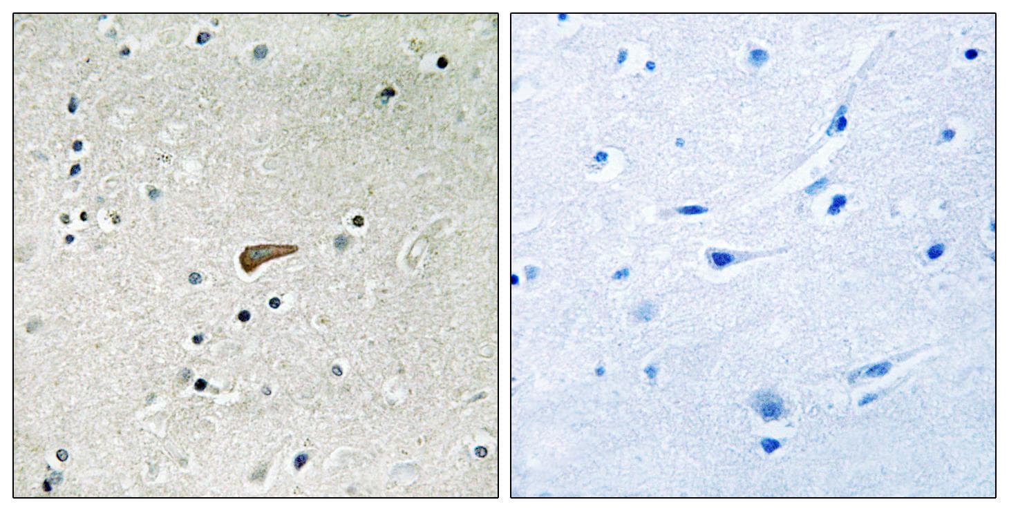 FRS2 Antibody (phospho-Tyr436)