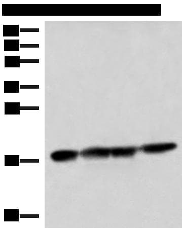 Polyclonal Rabbit anti-Human PEMT Antibody (WB)