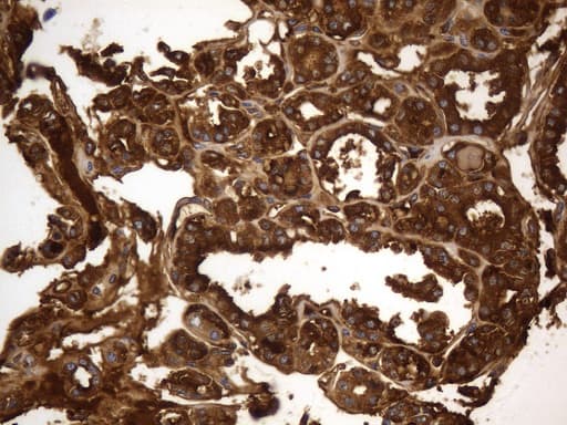 Monoclonal Mouse anti-Human TG / Thyroglobulin Antibody (clone UMAB270, Carrier-free, aa20-358, IHC)