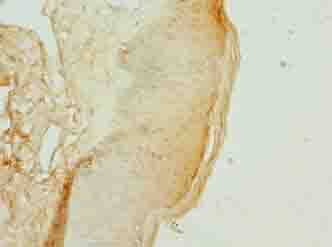 KRTAP3-2 Antibody