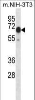 Polyclonal Rabbit anti-Mouse CAMKK2 Antibody (aa43-71, WB)
