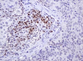 MGMT Antibody (clone OTI4E6, Carrier-free)