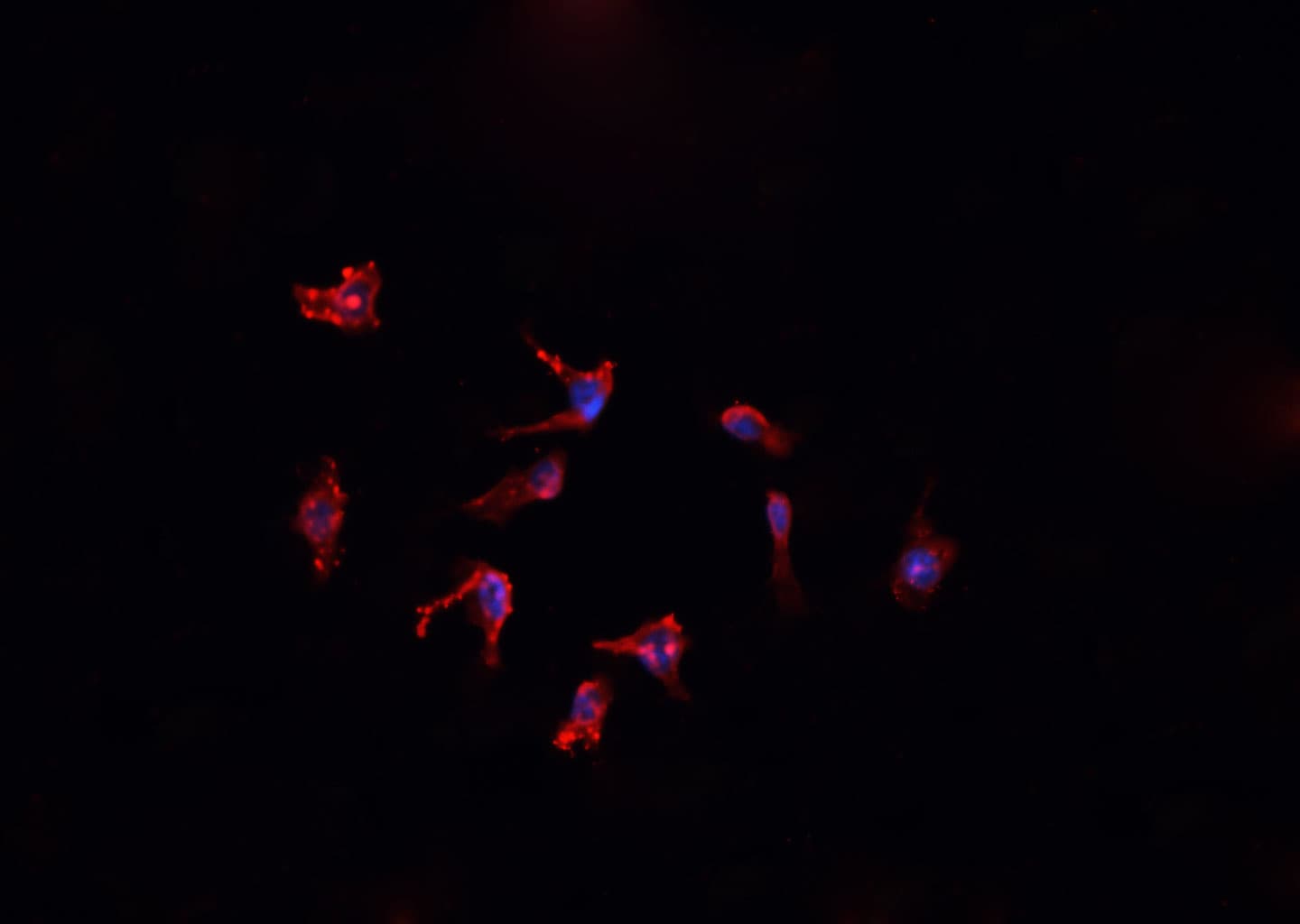 FTL / Ferritin Light Chain Antibody