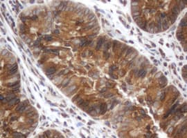 SRPRB Antibody (clone OTI3E6)