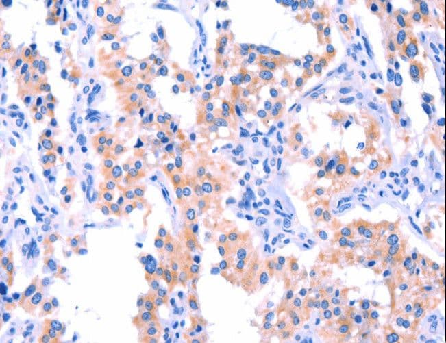 ERN2 Antibody
