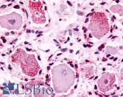PathPlus™ MRGPRX4 / MRGX4 Antibody (N-Terminus)
