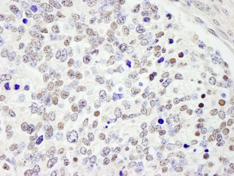 Polyclonal Rabbit anti-Human CDC25C Antibody (aa150-200, IHC)