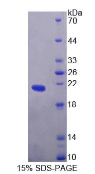 Human EDN2 / Endothelin 2 Protein (Recombinant His-T7)
