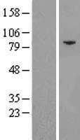 EIF2B5 Protein (Over-Expression Lysate Myc-DDK (Flag))