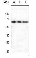 Polyclonal Rabbit anti-Human ER Alpha / Estrogen Receptor Antibody (WB)