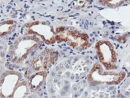 Monoclonal Mouse anti-Human FDFT1 / Squalene Synthase Antibody (clone OTI2F10, IHC, IF, WB)
