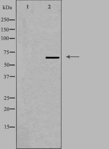 PPP2R1B Antibody