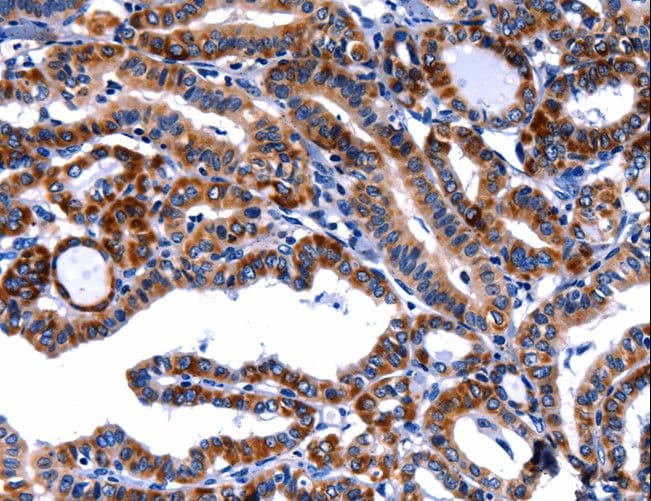 FBN1 / Fibrillin 1 Antibody