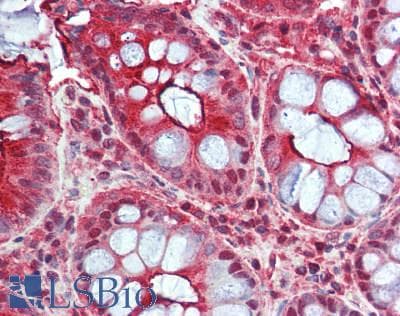 Polyclonal Rabbit anti-Human FAM173B Antibody (IHC, WB)