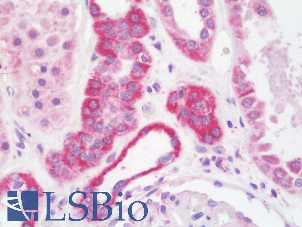 IHC-plus™ NDUFV1 Antibody (aa218-459)