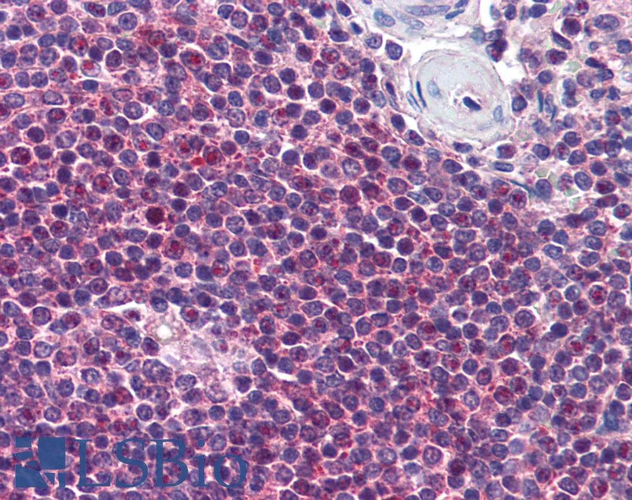 IHC-plus™ HCAR3 / GPR109B / HM74 Antibody (aa1-50)