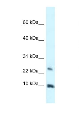 HMGN3 Antibody (C-Terminus)