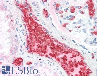 Polyclonal Rabbit anti-Human HBA1+2 / Hemoglobin Alpha Antibody (IHC, WB)