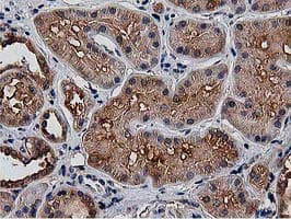 HDAC6 Antibody (clone OTI3E7)