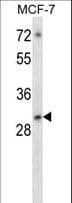 ATF5 Antibody (aa188-216)