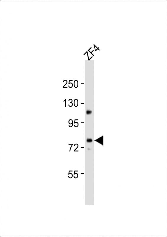 MTM1 / Myotubularin Antibody (aa451-485)