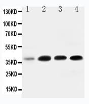 IGFBP3 Antibody (aa182-198)
