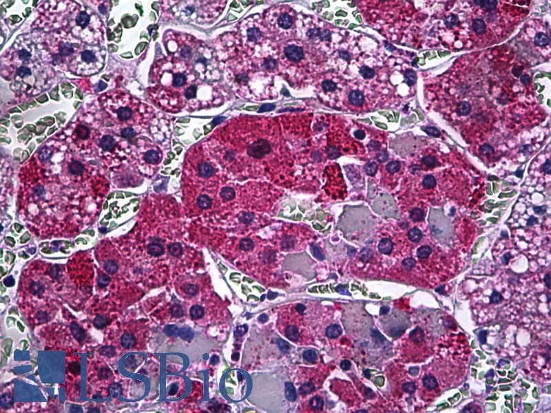 IHC-plus™ CAMKK1 Antibody (clone 1F6)
