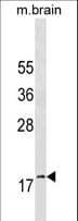 GABARAP Antibody