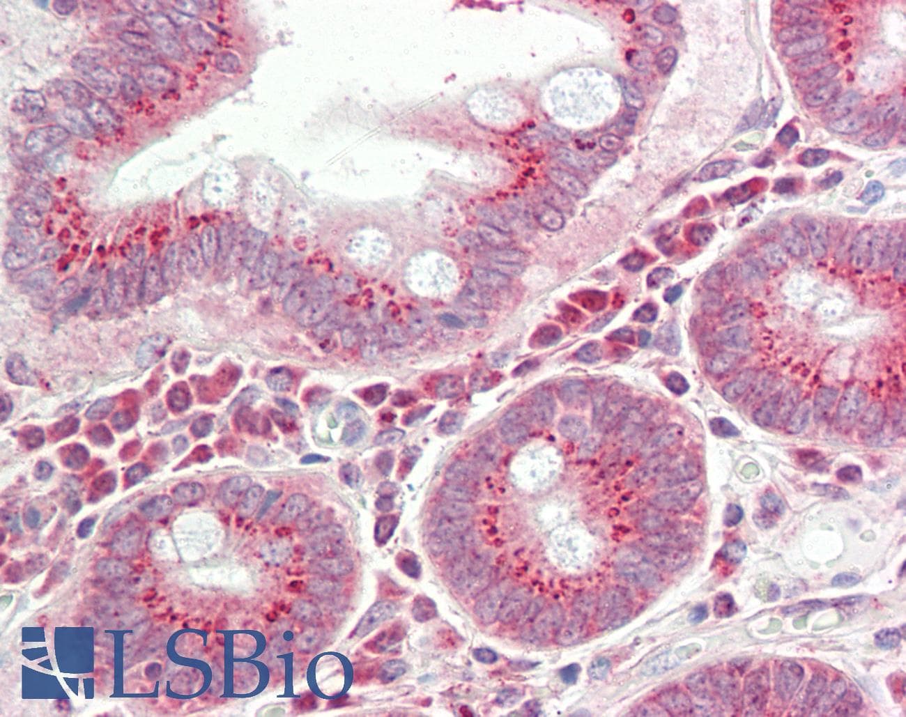 IHC-plus™ RPS12 / Ribosomal Protein S12 Antibody (aa15-44)