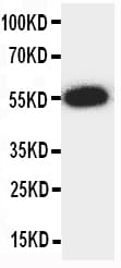 ANGPTL3 Antibody (aa32-48)