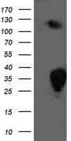 Monoclonal Mouse anti-Human PGAM2 Antibody (clone OTI4H1, IF, WB)