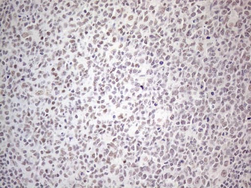 MMP2 Antibody (aa228-507, clone OTI4A11)