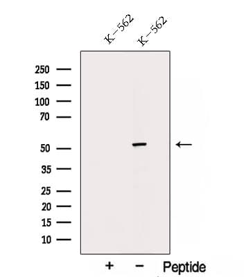 Polyclonal Rabbit anti-Human TRIM11 Antibody (WB)