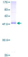 Human SDS Protein (Recombinant GST)