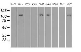 BUB1B / BubR1 Antibody (clone OTI11D7, Carrier-free)