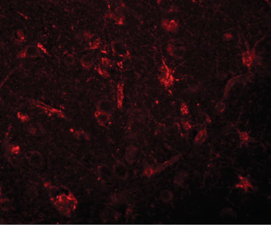 IHC-plus™ Polyclonal Rabbit anti-Human ZC3H12C Antibody (IHC, IF, WB)