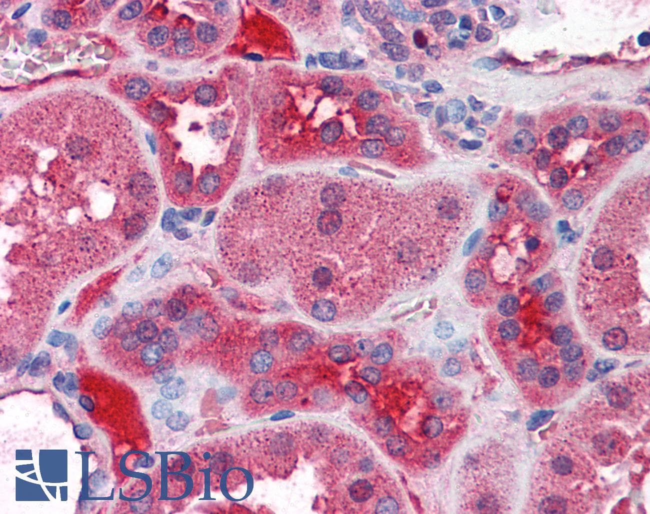 IHC-plus™ KCNN2 Antibody (aa545-557)