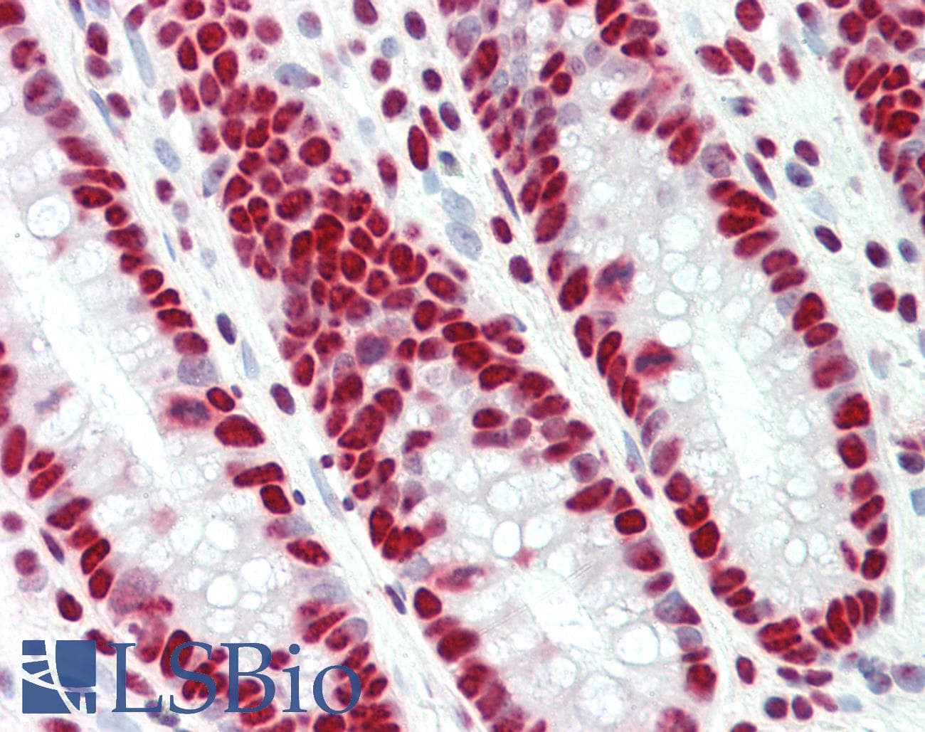 IHC-plus™ TAF15 Antibody (clone 4D71)